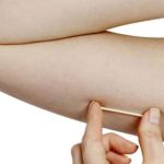 Implanon já está disponível nas Unidades Básicas de Saúde de União da Vitória